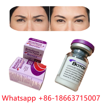 Allergan Botulinum Toksin Tip A  Toz Formu