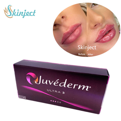 Juvederm Ultra3 2x1ml Hyaluronik Asit Yüz Dolgu Maddeleri Dermal