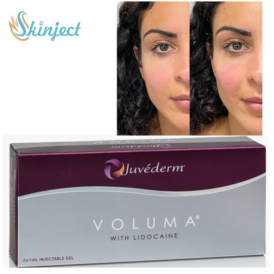 Elmacık kemiği için Juvederm Voluma 2x1ml Hyaluronik Asit Dermal Dolgu Maddeleri