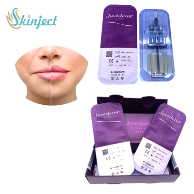 Juvederm Ultra4 Dudak Büyütme Dermal Dolgu Maddeleri Hyaluronik Asit