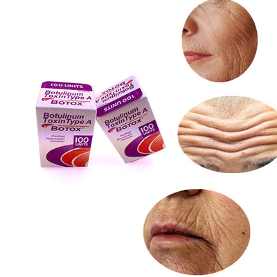 Büyüme Çizgileri Alın Çizgileri İçin Allergan 100 IU Botulinum Toksini Çıkarın