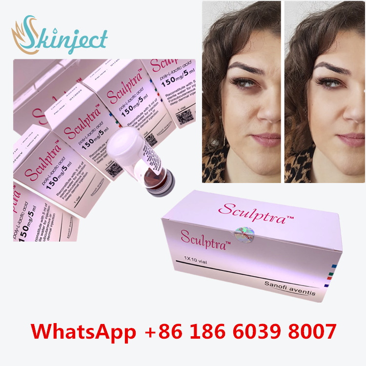 Batık yüzü kaldırmak için  Poly-L-Laktik-Asit PLLA Enjeksiyonu