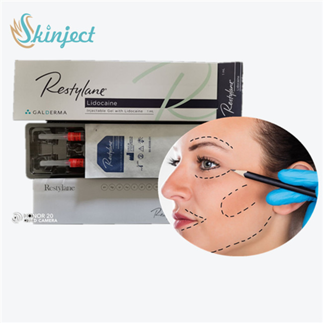 İnce Kırışıklıklar İçin Enjekte Edilebilir Dermal Dolgu Juvederm  Dolgu Maddeleri