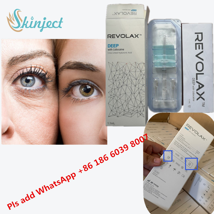 Çapraz Bağlantılı Dermal Dolgu Revolax Filler Çapraz Bağlantılı HA Hyaluronik Asit 24 Mg/Ml