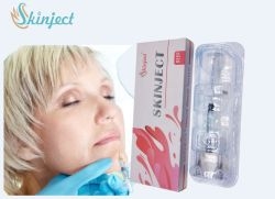 Yüz / Burun / Dudak / Çene Hyaluronik Asit Dermal Dolgu 2 Yıllık Kalıcılık