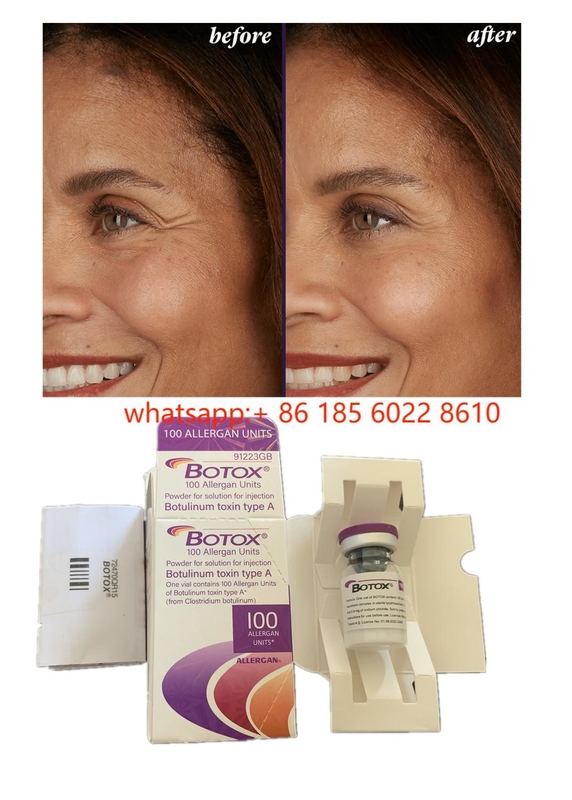Güzellik Ürünleri Allergan 100birim Botulinum Toksin Yüz kırışıklıkları için  Dermal Filler