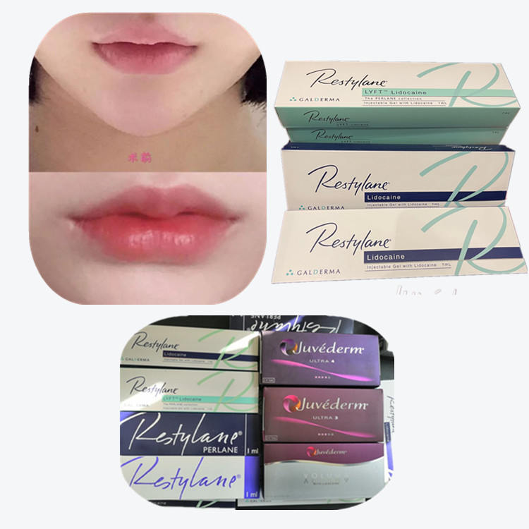 Hyaluronic Acid Dermal Filler HA Filler for Eyes, Mouth and Nose