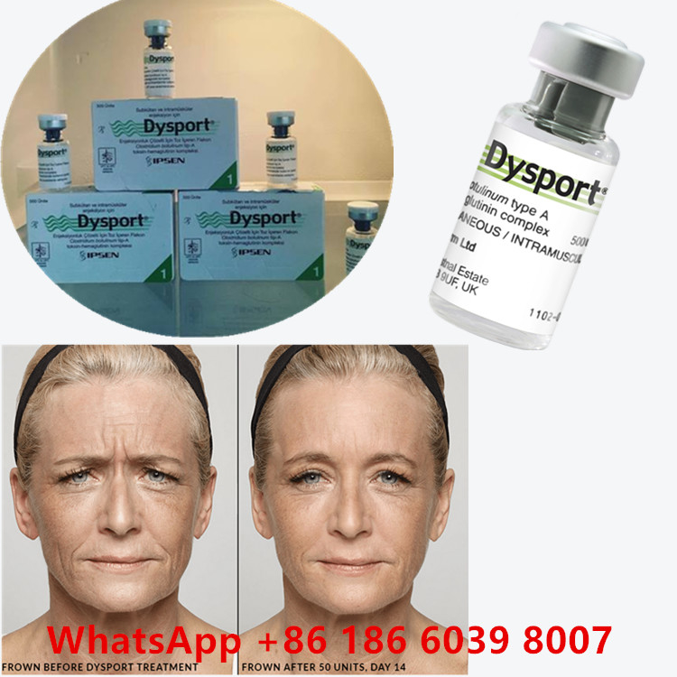 Botulinum Toksin 100 Birim BTX Enjeksiyon Tip A Kozmetik Kullanım