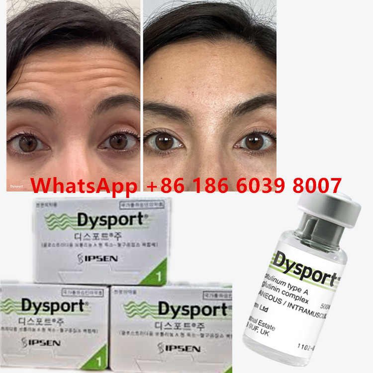 Botulinum Toksin Dysport Clostridium Botulinum Tip A 500 Birim/ şişe