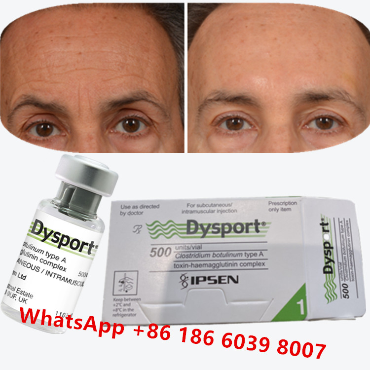 Botulinum Toksin Dysport Clostridium Botulinum Tip A Karga Ayakları İçin