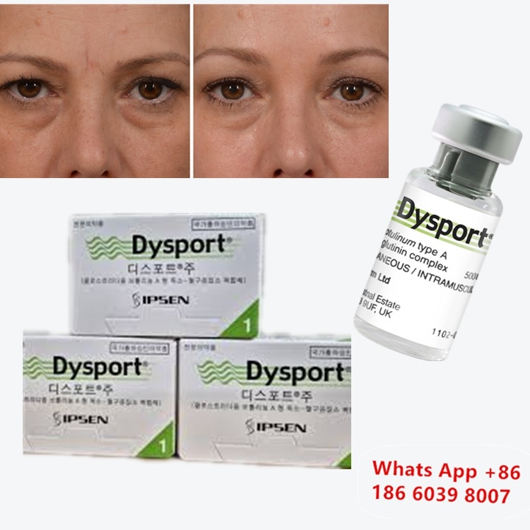 Botulinum Toksin Dysport Clostridium Botulinum Tip A Burun Düzeltme İçin