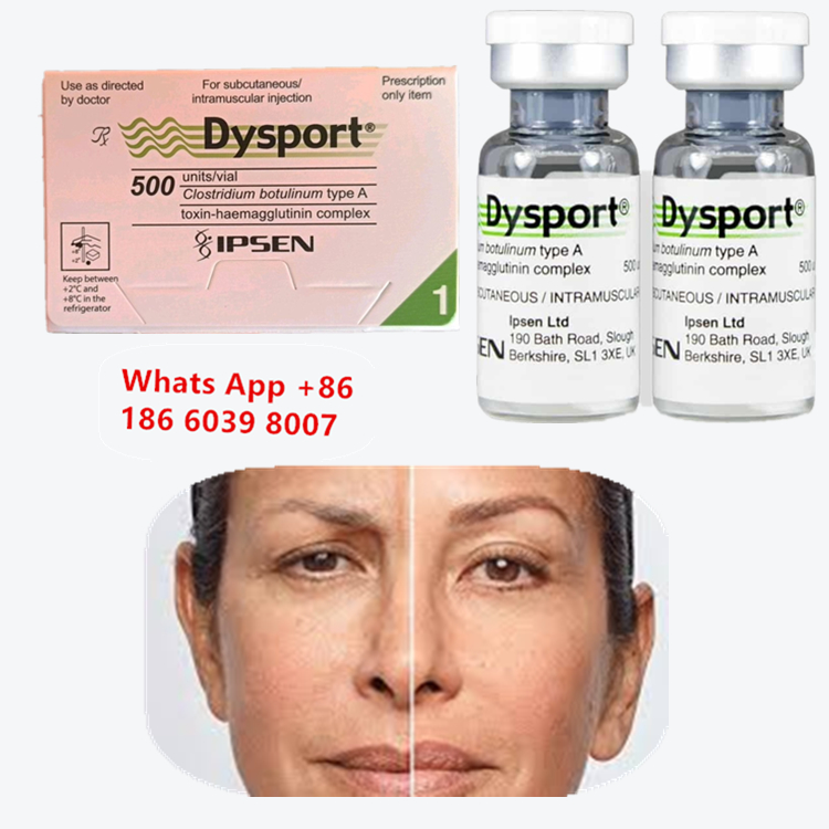 Dysport Botulinum Toksin Tip A Kırışıklık Karşıtı Enjeksiyonu (Ağız Çevresi Çizgileri İçin)