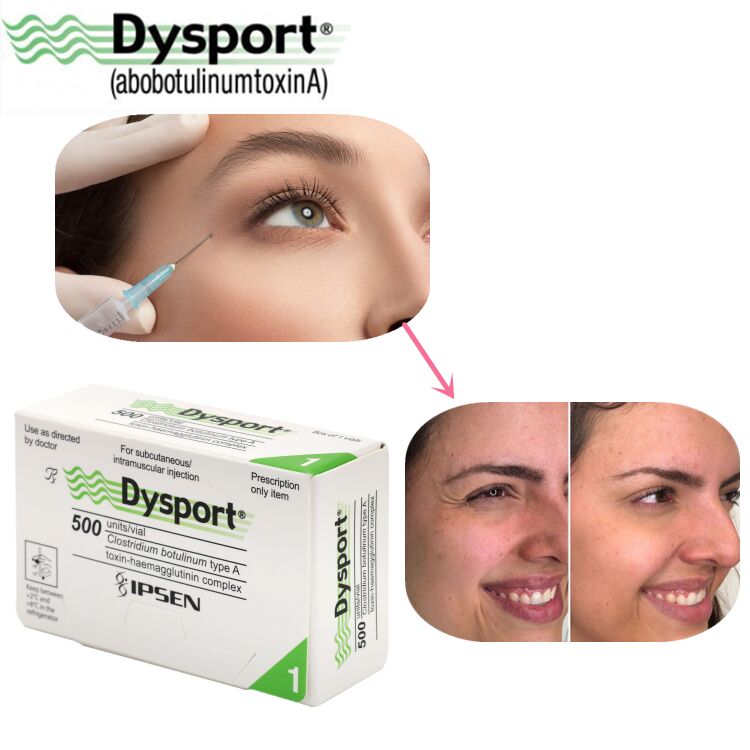 500u Dysport Yüz kırışıklığı yok oluşu Dondurulmuş toz işleme Özel OEM Dysport