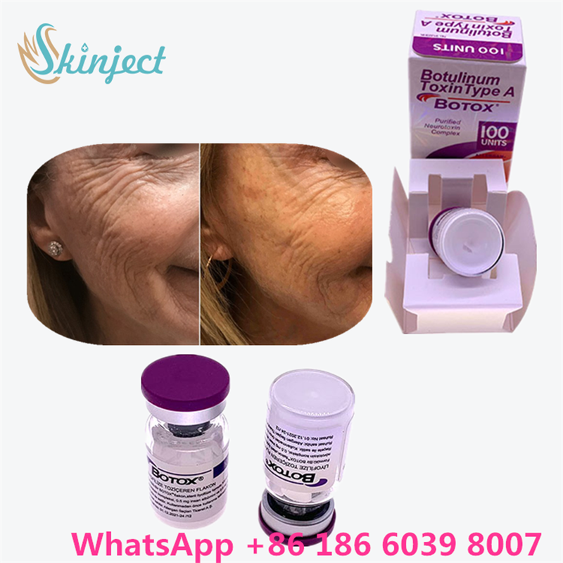Botulinum Toksin Allergan Botox Beyaz Toz, Yüz Çizgileri ve Kas Gevşetme İçin Etkili Tedavi