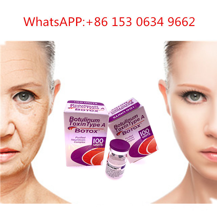 50u 100u 150u A Tipi Allergan  Enjeksiyonu Kırışıklık Karşıtı Botulinum Toksini