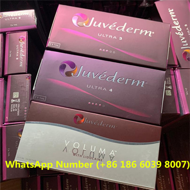 Juvederm Smile Line Öncesi ve Sonrası Gözyaşı Olukları İçin Enjekte Edilebilir Dermal Dolgu