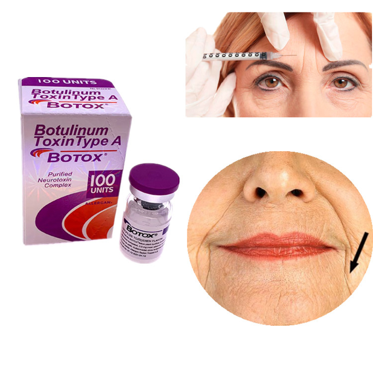 Allergan Botox 100IU Botulinum Toksin Tipi A Yüz ve Gözler Düzeltme Karışıklıkları