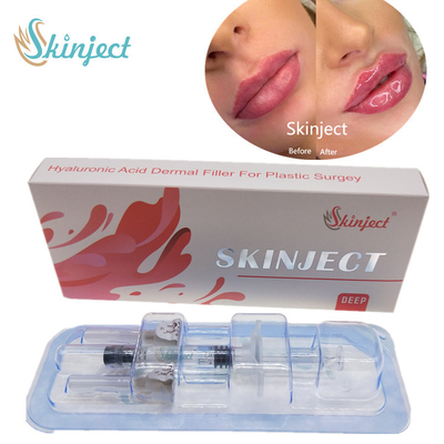 Skinject Derin Hyaluronik Asit Dermal 2ml Dudak Dolguları Enjekte Edilebilir