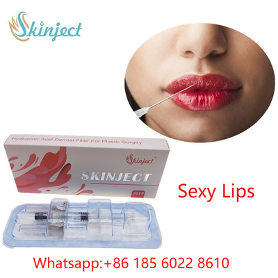 Skinject Derin Hyaluronik Asit Dermal Dolgu 2ml Çapraz Bağlantılı Enjekte Edilebilir